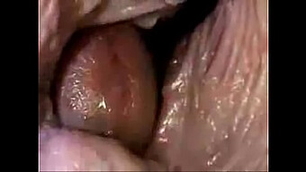 Vaginal Pe...